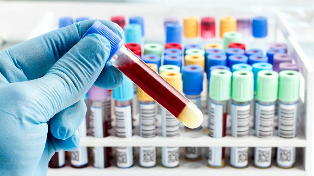 Pathology diagnostic equipment