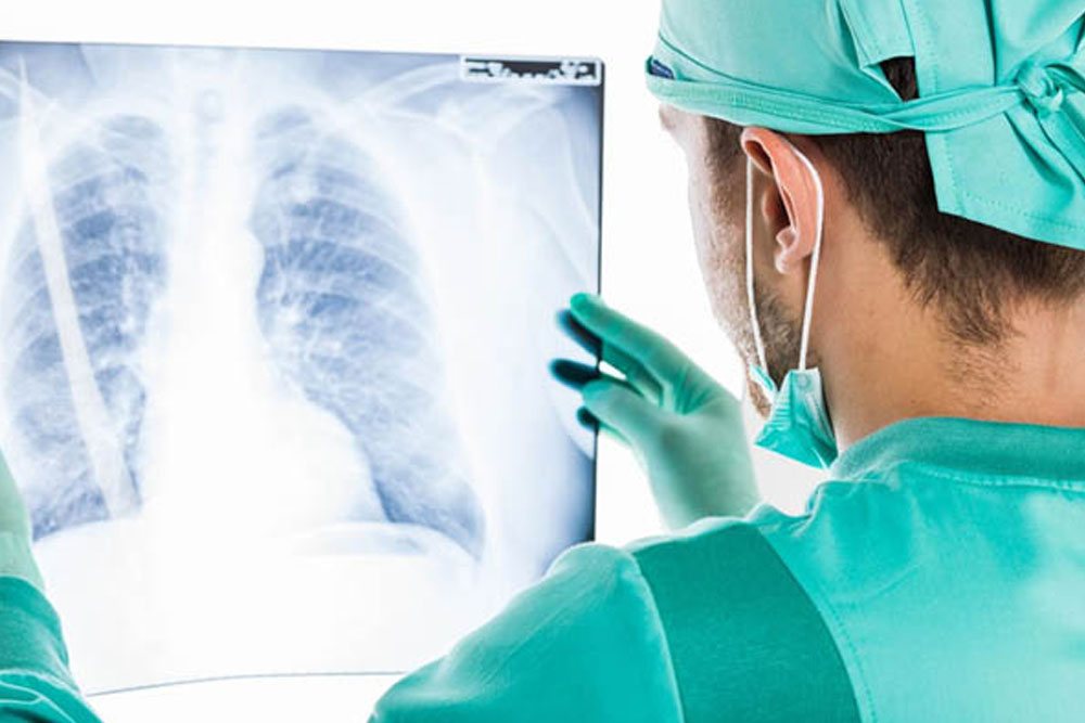 Radiology professional reviewing a chest radiograph